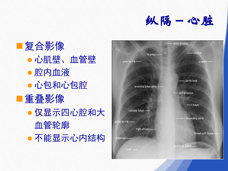 胸部CT表现、鉴别和解剖要点课件.ppt_第2页