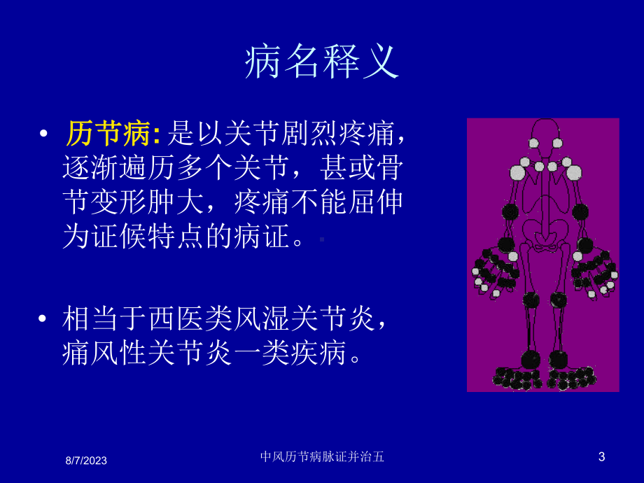 中风历节病脉证并治五培训课件.ppt_第3页