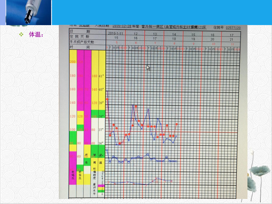 造口旁疝护理查房.pptx_第3页