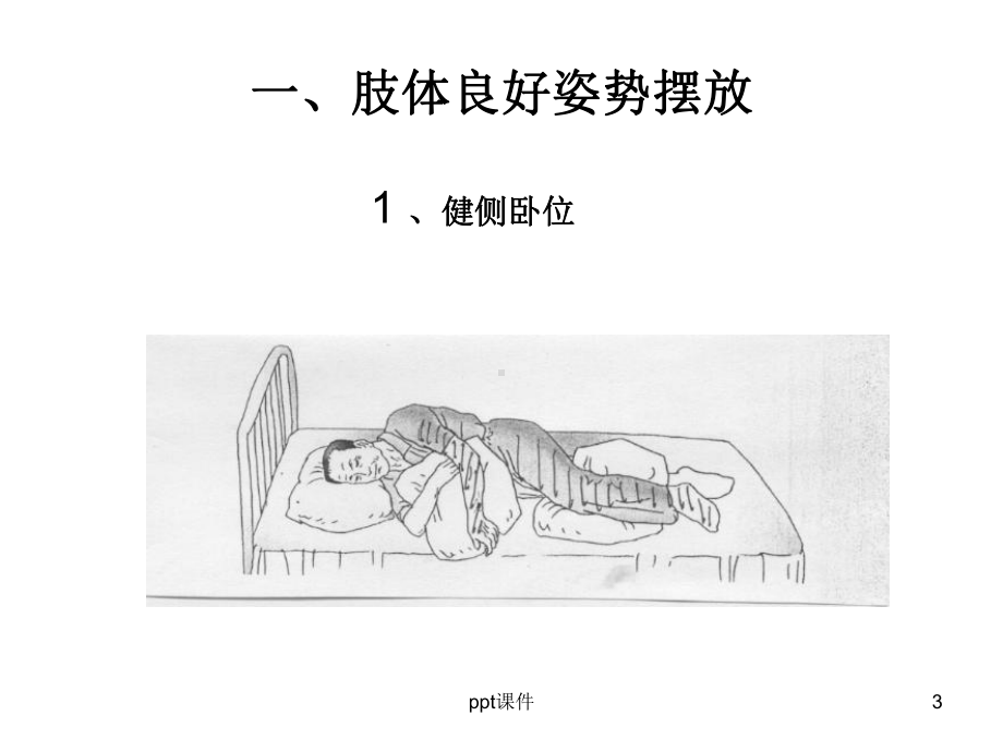 偏瘫康复训练-课件.ppt_第3页