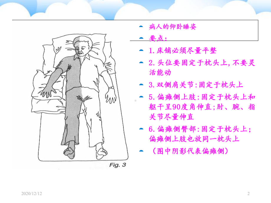 偏瘫患者肢体功能位护理-课件.ppt_第2页