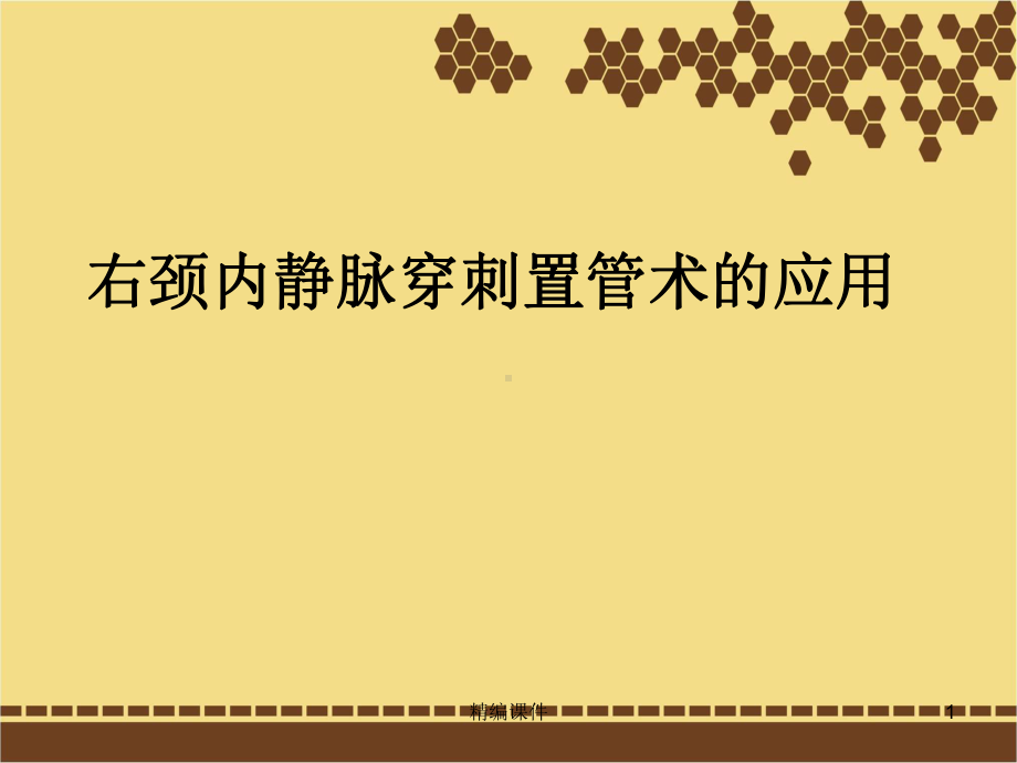 颈内静脉穿刺置管术（培训学习）.ppt_第1页