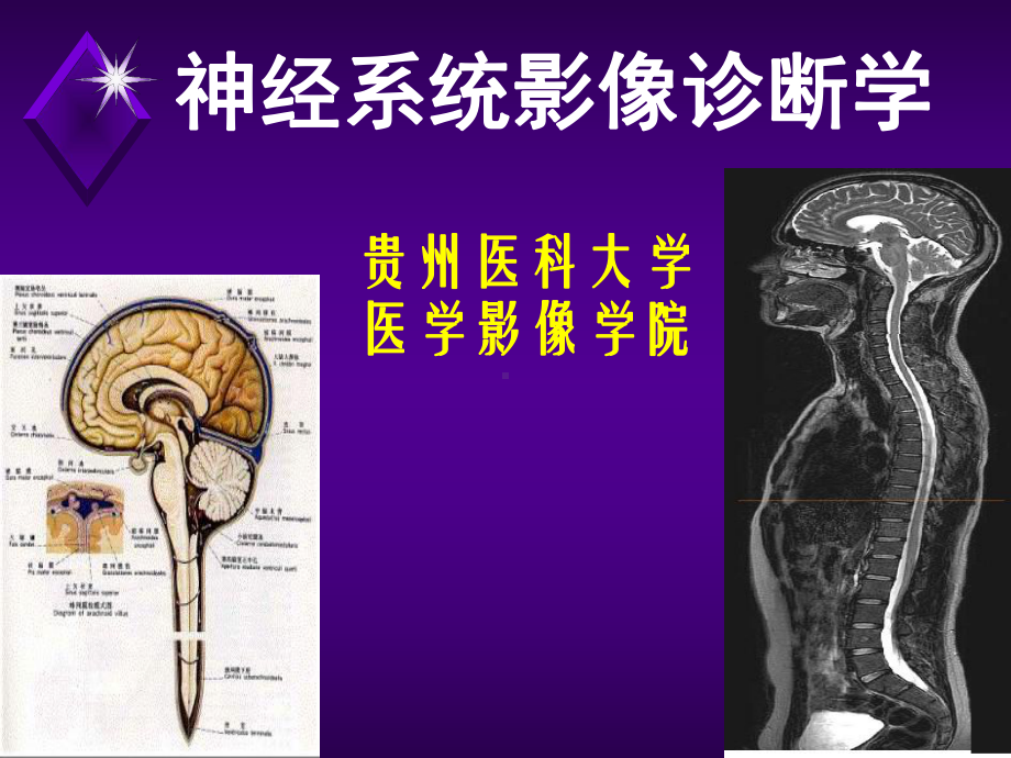 神经系统影像诊断学课件.ppt_第1页