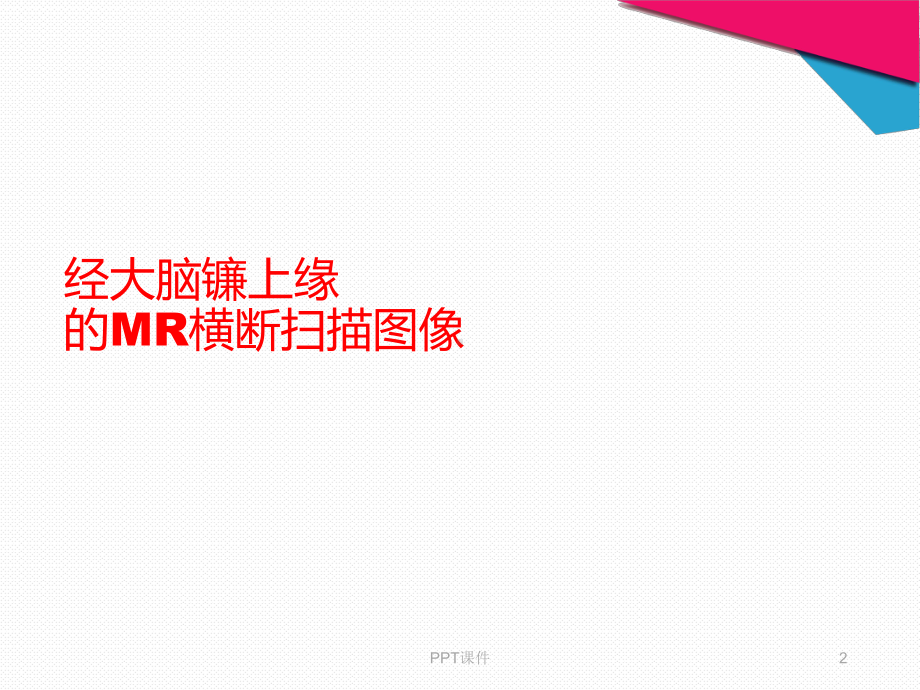 头部MR横断层-课件.ppt_第2页