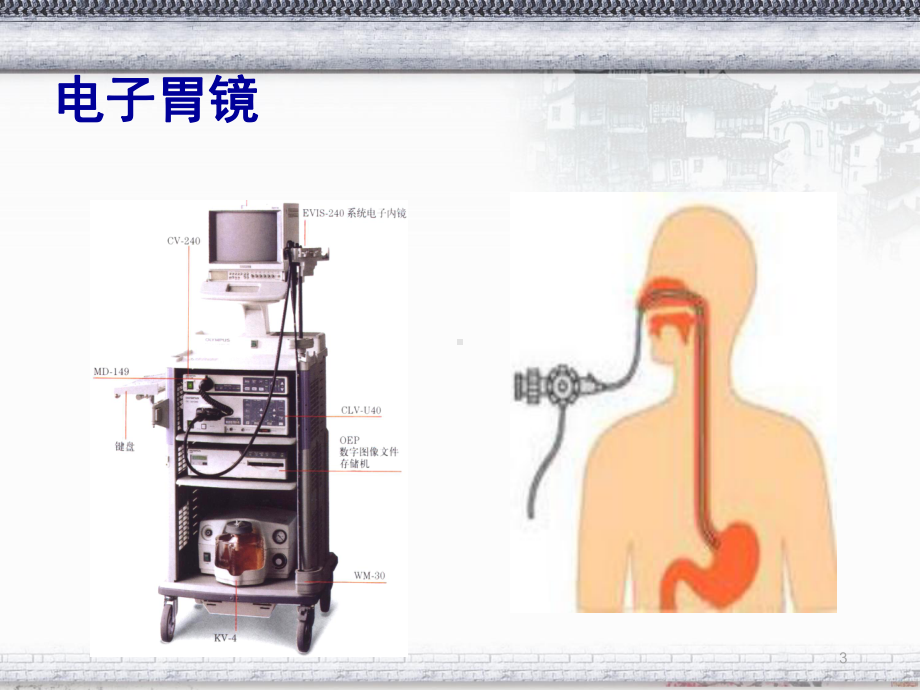 常见消化内镜的诊治课件.ppt_第3页