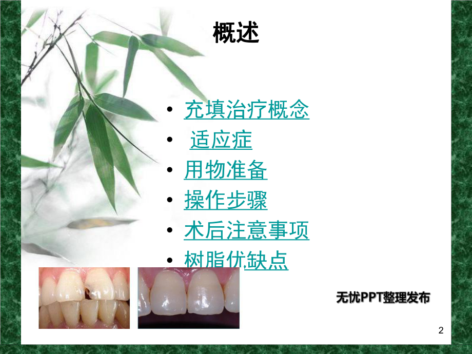 光固化复合树脂充填术(课堂PPT).ppt_第2页