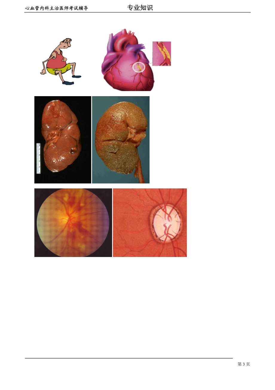 心血管内科主治医师资格笔试专业知识考点解析(5)：高血压病.doc_第3页