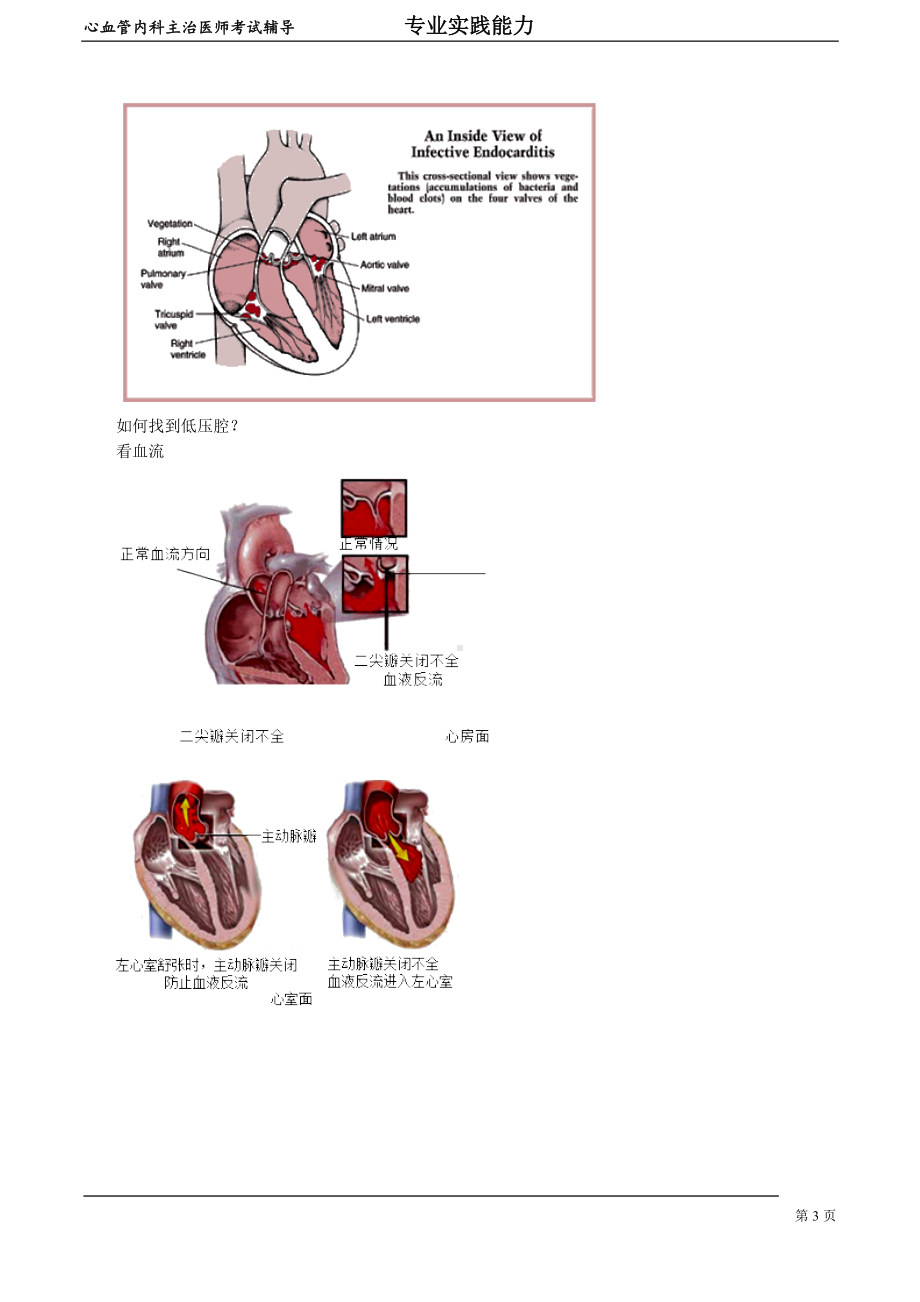 心血管内科主治医师资格笔试专业实践能力考点解析 (9)：感染性心内膜炎.doc_第3页