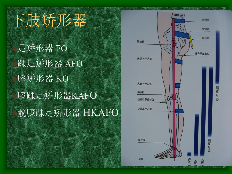 下肢矫形器的种类与应用.ppt_第2页