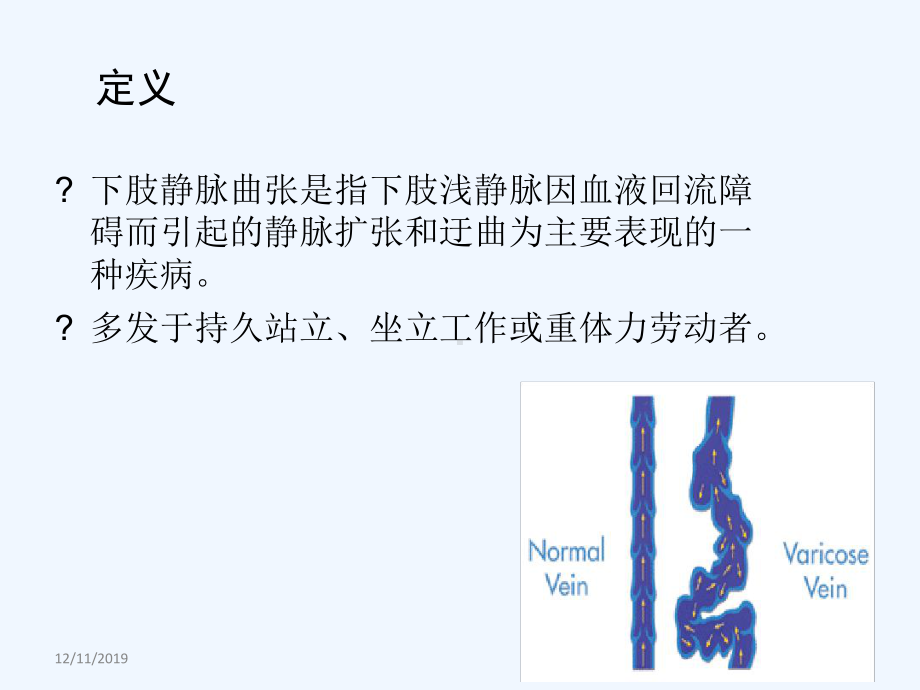 下肢静脉曲张手术方式及并发症的护理.ppt_第2页