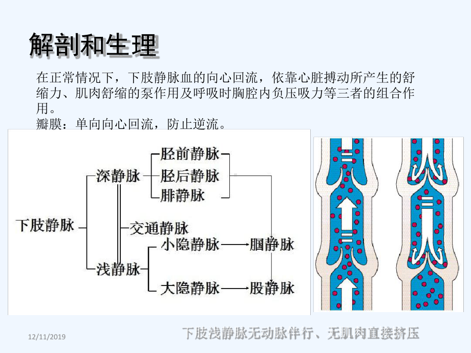 下肢静脉曲张手术方式及并发症的护理.ppt_第3页