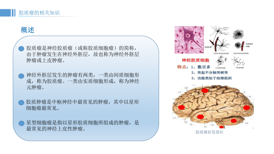 脑胶质瘤患者的护理查房课件.ppt_第3页