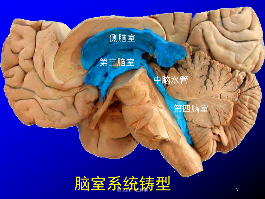 脑室的断层解剖培训课件.ppt（35页）_第3页