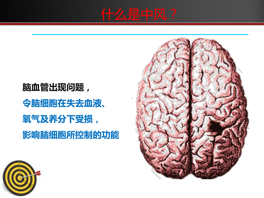 防微杜渐预防卒中--课件.ppt（48页）_第3页