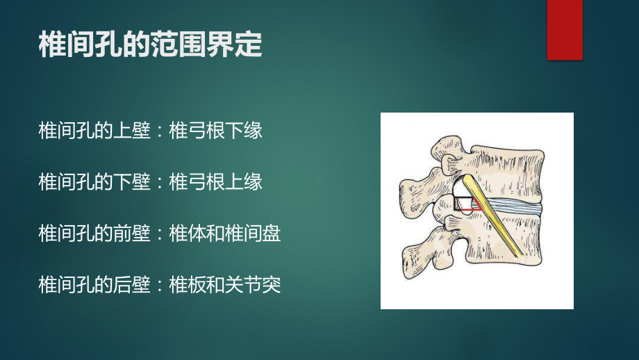 椎间孔的解剖(ppt课件).pptx_第3页