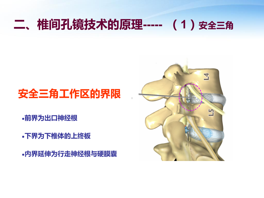 椎间孔镜技术(ppt课件).ppt_第3页