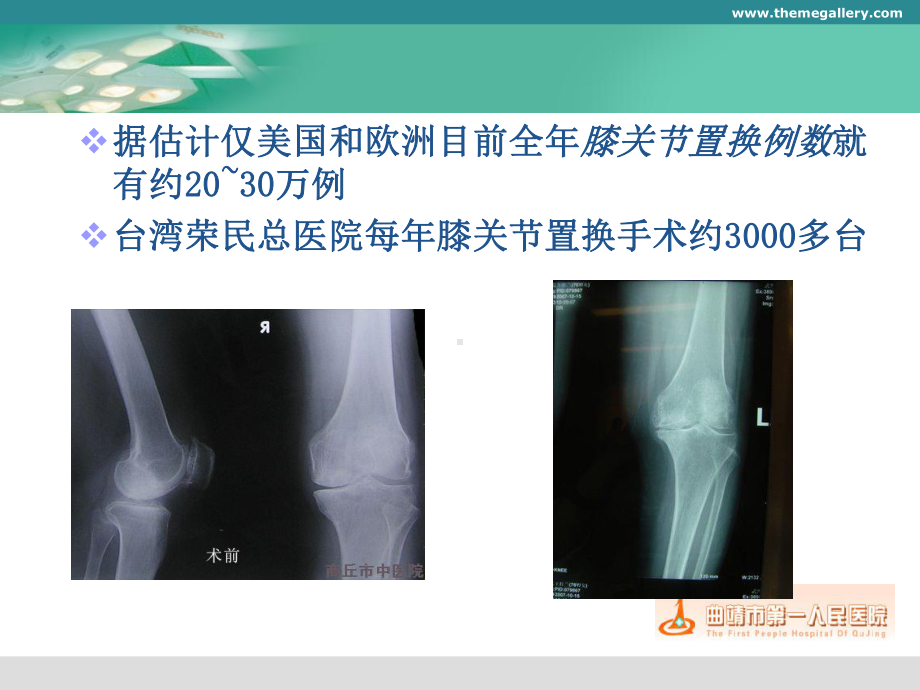 膝关节置换的手术操作和技巧（课件）.ppt_第2页