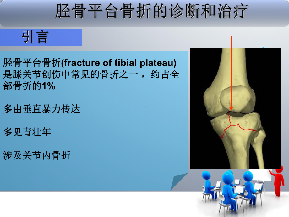 胫骨平台骨折（课件）.ppt_第3页