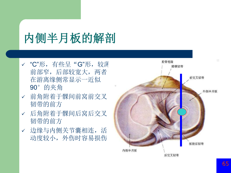 膝关节半月板损伤MRI诊断(ppt)（课件）.ppt_第2页