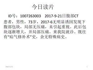 腹膜后脂肪肉瘤影像学表现与鉴别诊断.ppt