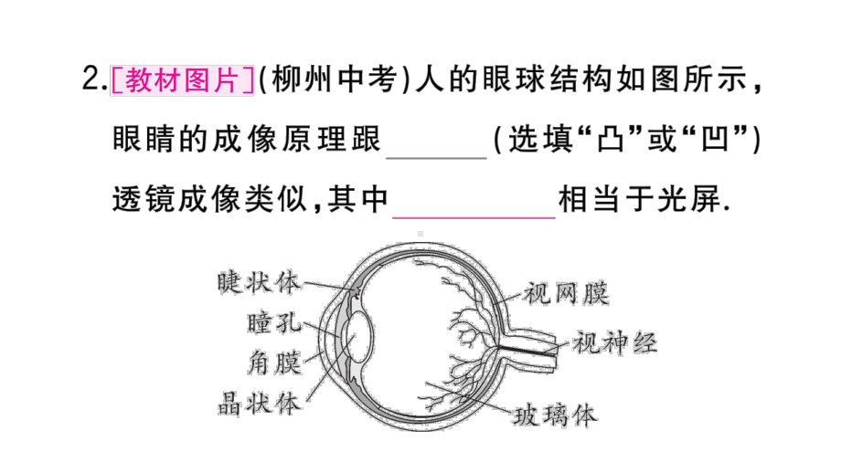 初中物理新人教版八年级上册第五章第4节 眼睛和眼镜作业课件2024秋季.pptx_第3页