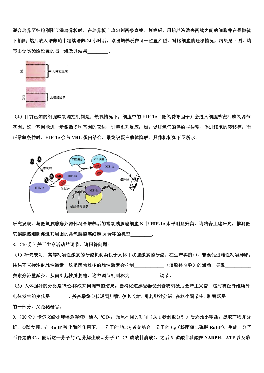 山西省朔州市平鲁区李林中学2024年高三考前热身生物试卷含解析.doc_第3页