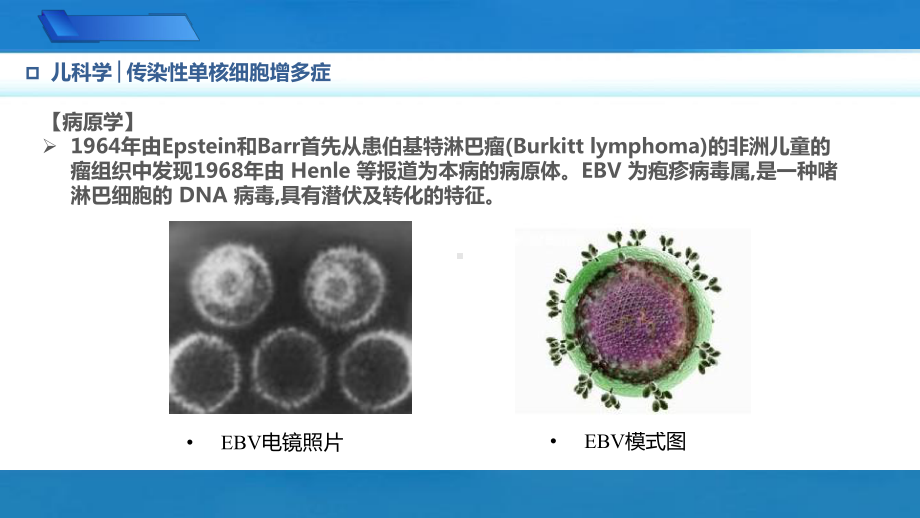 传染性单核细胞增多症儿科学人卫版第10版教材PPT课件下载龙殿法第十版9.1.4.pptx_第3页