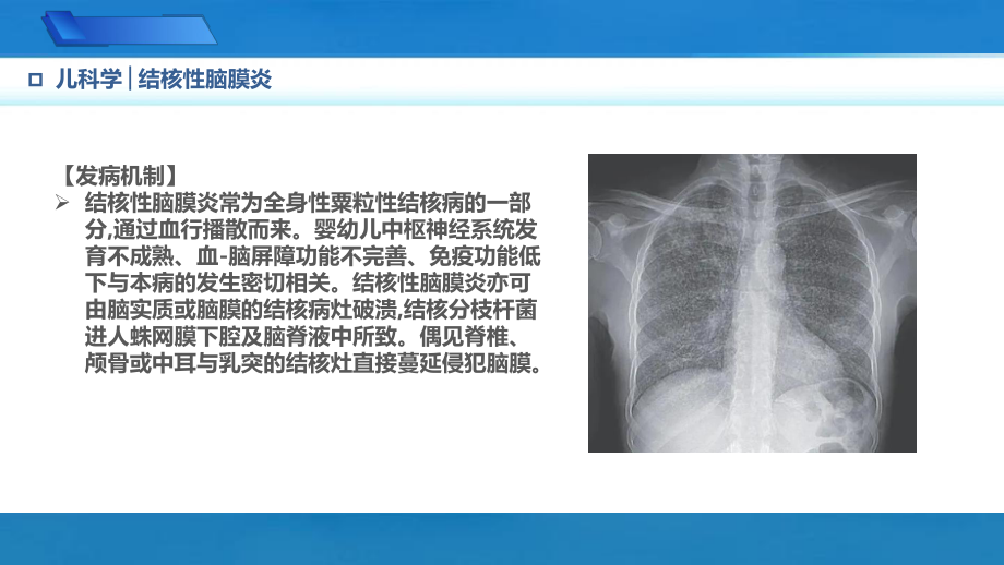 9.3.4结核性脑膜炎儿科学人卫版第10版教材PPT课件下载龙殿法第十版.pptx_第3页