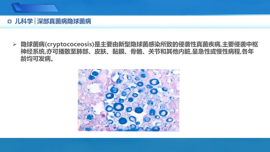 9.4.2深部真菌病隐球菌病儿科学人卫版第10版教材PPT课件下载龙殿法第十版.pptx_第3页