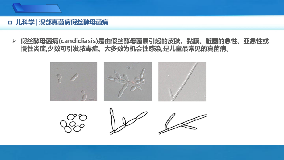 9.4.1深部真菌病假丝酵母菌病儿科学人卫版第10版教材PPT课件下载龙殿法第十版.pptx_第3页