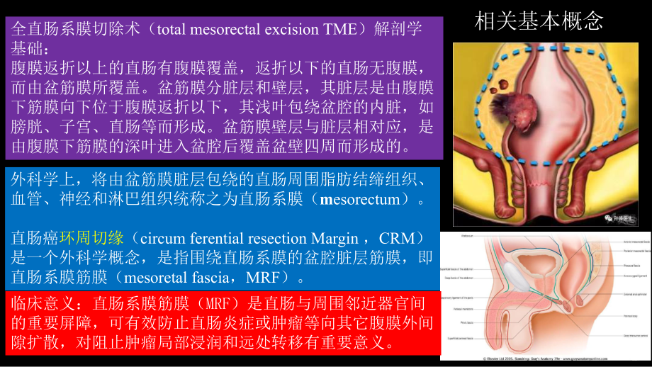 直肠癌：MRI与临床 ppt课件-人卫版《影像与诊断》.pptx_第3页