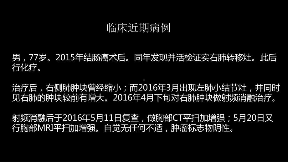 这例肺部病灶的比较影像学：价值评判 ppt课件-人卫版《影像与诊断》.pptx_第3页