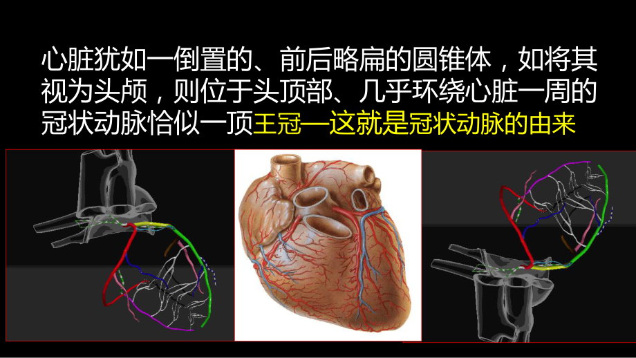 多层螺旋CT冠状动脉疾病诊断再学习之一 ppt课件-人卫版《影像与诊断》.ppt_第3页